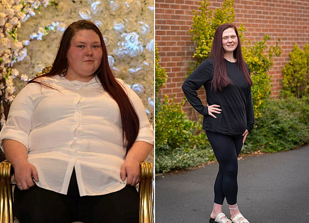 Byla závislá na chipsech, pak se žena rozhodla pro změnu a radikálně zhubla